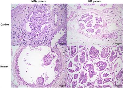 COX-2 expression in mammary invasive micropapillary carcinoma is associated with prognostic factors and acts as a potential therapeutic target in comparative oncology